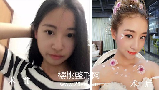 武汉伽美医疗美容整形医院正规吗？做整形价格贵不贵？