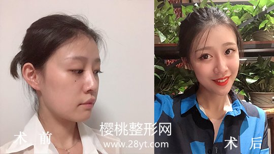 福州名韩整形美容正规吗？做整形价格贵不贵？