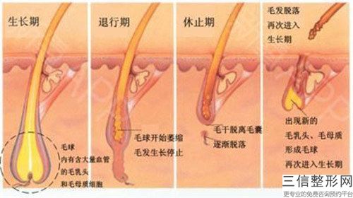 肇庆小腿激光脱毛术是什么价位「肇庆小腿激光脱毛手术一般什么价位」