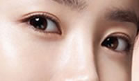 韩式双眼皮整形塑造魅力靓眼