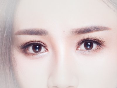 术后图片 术后图片