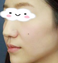 术前图片 术前图片