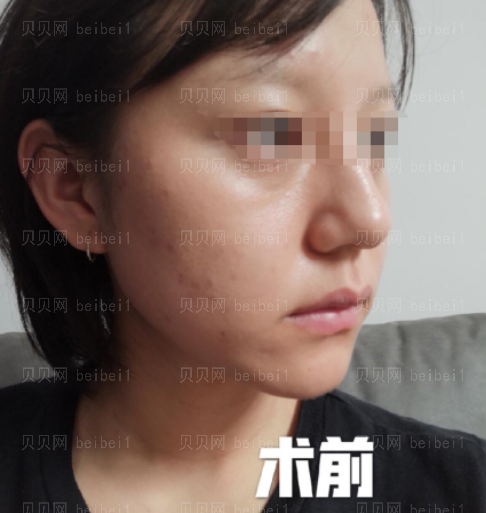 西京医院整形科樊星水光美肤介绍片较新分享_经过这次皮肤治疗，我也有了更大的信心了哦。