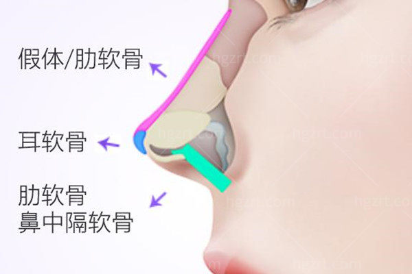 鼻部整形