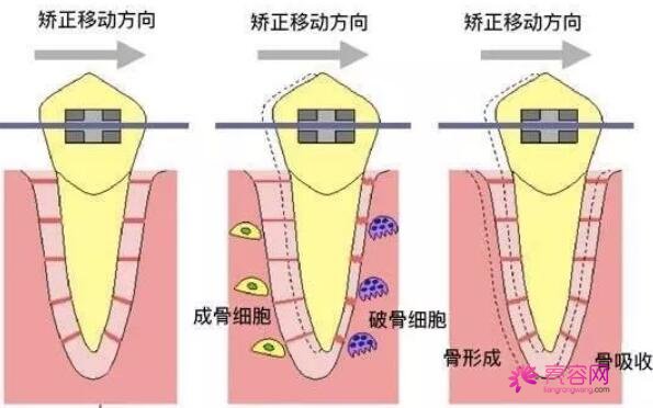 兰州康美口腔葛振林医生做牙齿矫正怎么样？医生详情+牙齿正畸案例