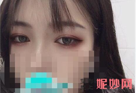 上海华美医疗美容医院好吗？医院介绍，附双眼皮整形案例和价格表！