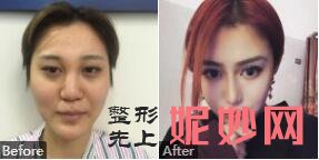 山东威海美神整形正规，不拉人头附威海美神技术怎么样_案例_价格表