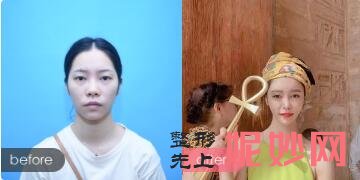 北京清木是私人整形医院吗?靠谱不?有保障吗?沈薇案例效果_价格表