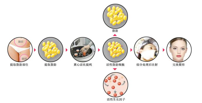 哈尔滨欧兰仁美医院：全面部填充一次体验 即可定格面部美丽