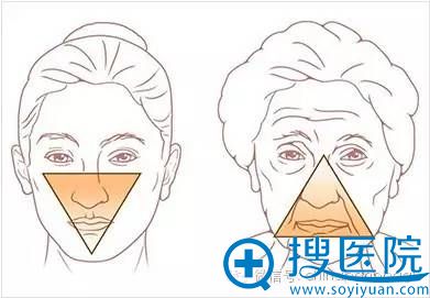 年轻女性与年长女性面部下垂对比图片
