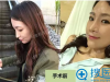 韩国id整容医院隆鼻失败修复案例 30岁上班族的鼻整形真实后记