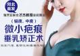 石家庄雅芳亚联合才杰教授推出微小疤痕垂乳矫正术 附真人案例