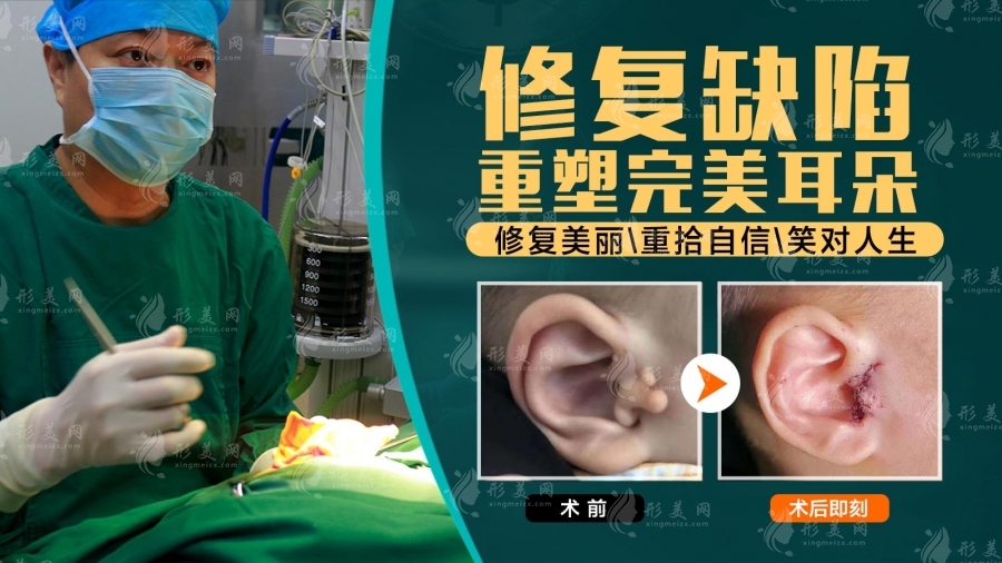 做耳朵畸形手术可以报销吗?这些耳再造医院有补助政策