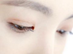 做完韩式双眼皮手术后注意哪些